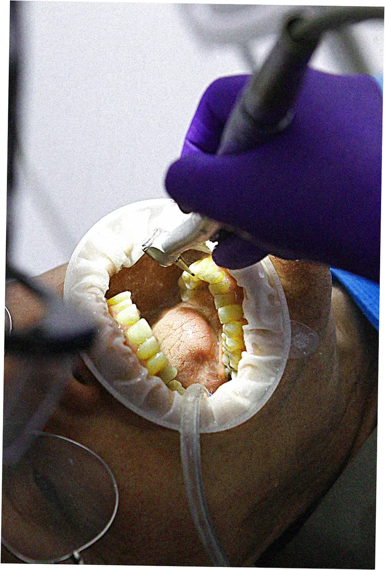 Can CareCredit be used for cosmetic dentistry?